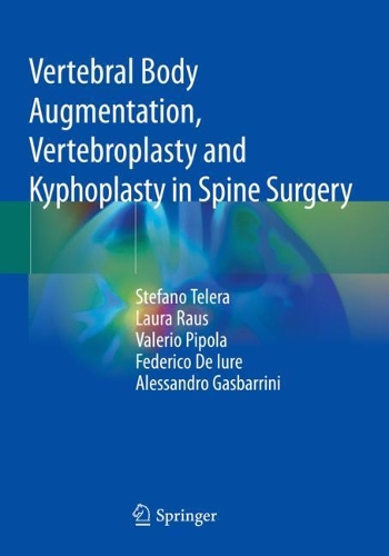 Бумажная книга «Vertebral Body Augmentation, Vertebroplasty and Kyphoplasty in Spine Surgery», авторов Алессандро Гасбаррини, Федерико Де Иуре, Лаура Раус, Стефано Телера, Валерио Пипола - фото №1