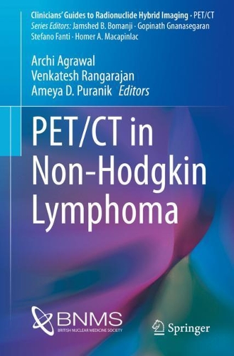 Паперова книга «PET/CT in Non-Hodgkin Lymphoma» - фото №1