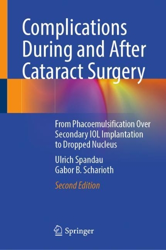 [object Object] «Complications During and After Cataract Surgery: From Phacoemulsification Over Secondary IOL Implantation to Dropped Nucleus», авторів Габор Б. Шаріот, Ульріх Шпандау - фото №1