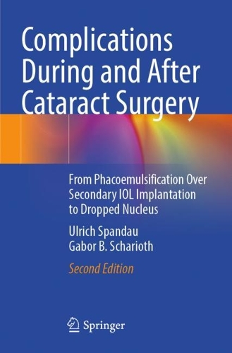 [object Object] «Complications During and After Cataract Surgery: From Phacoemulsification Over Secondary IOL Implantation to Dropped Nucleus», авторів Габор Б. Шаріот, Ульріх Шпандау - фото №1