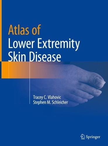 Бумажная книга «Atlas of Lower Extremity Skin Disease», авторов Стивен М. Шлейхер, Трейси К. Влахович - фото №1