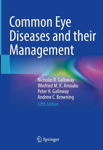 Паперова книга «Common Eye Diseases and their Management», авторів Ендрю Браунінг, Ніколас Р. Геллоуей, Пітер Г. Геллоуей, Вінфрід М. К. Амоаку - фото №1