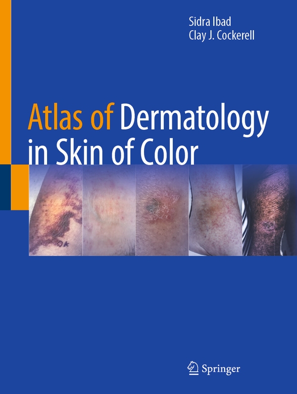 Паперова книга «Atlas of Dermatology in Skin of Color», авторів Клей Дж. Кокерелл, Сидра Ібад - фото №1