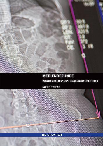 Бумажная книга «Medienbefunde: Digitale Bildgebung und diagnostische Radiologie», автор Катрин Фридрих - фото №1