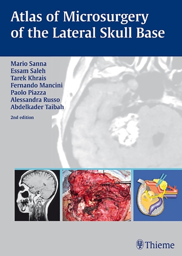 Бумажная книга «Atlas of Microsurgery of the Lateral Skull Base», авторов Абделькадер Тайбах, Алессандра Руссо, Эссам А. Салех, Фернандо Манчини, Марио Санна, Паоло Пьяцца, Тарек Храис - фото №1