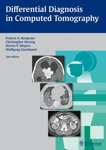 Paper book «Differential Diagnosis in Computed Tomography», authors Christopher Herzog, Francis A. Burgener - фото №1