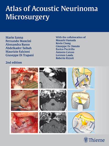 Бумажная книга «Atlas of Acoustic Neurinoma Microsurgery», авторов Абделькадер Тайбах, Алессандра Руссо, Фернандо Манчини, Джузеппе Ди Трапани, Марио Санна, Маурицио Фальчиони - фото №1