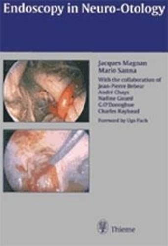Бумажная книга «Endoscopy in Neuro-Otology and Skull Base Surgery (AT)», авторов Жак Маньян, Марио Санна - фото №1