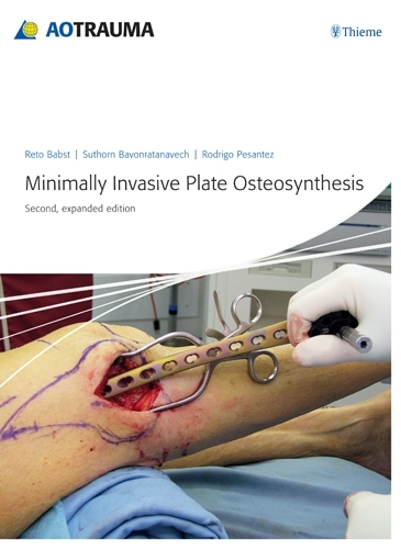 Паперова книга «Minimally Invasive Plate Ostheosynthesis», авторів Рето Бабст, Родріго Ф. Песантес, Суторн Бавонратанавеч - фото №1