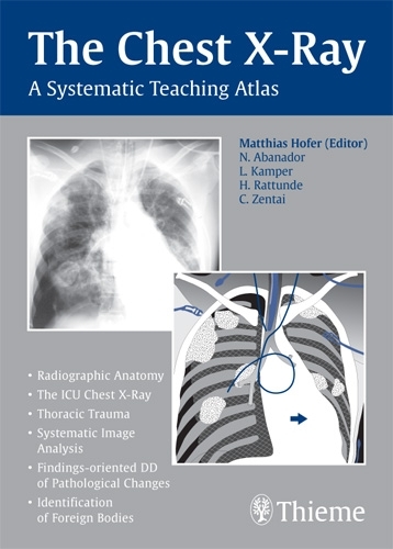 Paper book «The Chest X-Ray: A Systematic Teaching Atlas», author Matthias Hofer - фото №1