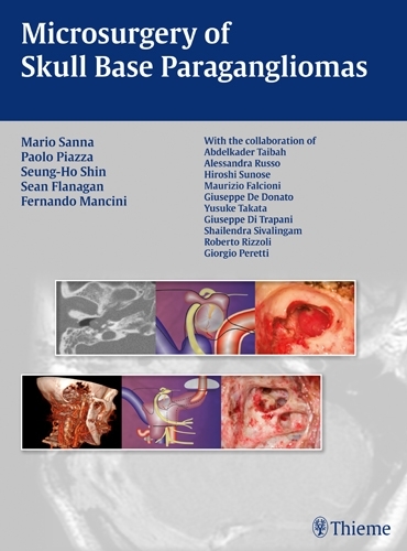 Бумажная книга «Microsurgery of Skull Base Paragangliomas», авторов Фернандо Манчини, Марио Санна, Паоло Пьяцца, Шон Фланаган, Сын Хо Шин - фото №1