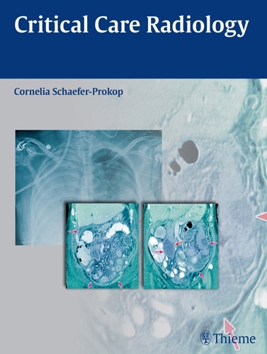 Паперова книга «Critical Care Radiology», автор Корнелія Шефер-Прокоп - фото №1