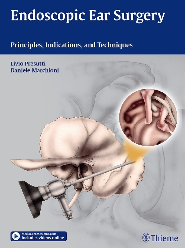 Паперова книга «Endoscopic Ear Surgery: Principles, Indications, and Techniques», авторів Даніеле Марчіоні, Лівіо Пресутті - фото №1