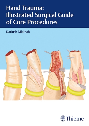 Бумажная книга «Hand Trauma: Illustrated Surgical Guide of Core Procedures», автор Дариуш Никхах - фото №1