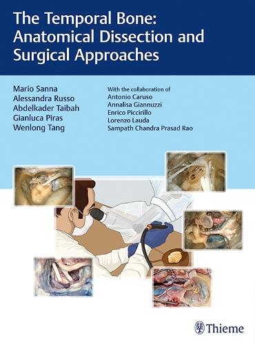 Бумажная книга «The Temporal Bone: Anatomical Dissection and Surgical Approaches», авторов Абделькадер Тайбах, Алессандра Руссо, Джанлука Пирас, Марио Санна, Вэньлун Тань - фото №1