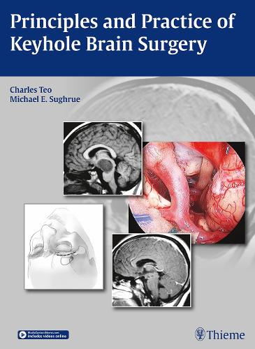 Бумажная книга «Principles and Practice of Keyhole Brain Surgery», авторов Чарльз Тео, Майкл Э. Согрю - фото №1