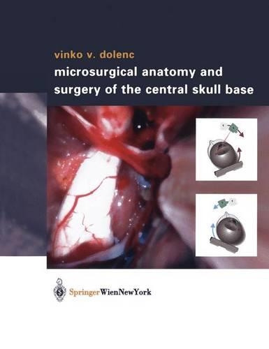 Бумажная книга «Microsurgical Anatomy and Surgery of the Central Skull Base», автор Винко В. Доленк - фото №1