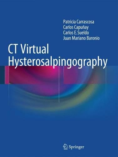 Паперова книга «CT Virtual Hysterosalpingography», авторів Карлос Капуньяй, Карлос Е. Суельдо, Хуан Маріано Бароніо, Патриція Карраскоса - фото №1