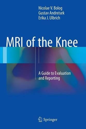 Бумажная книга «MRI of the Knee: A Guide to Evaluation and Reporting», авторов Эрика Дж. Ульбрих, Густав Андрейсек, Николае В. Болог - фото №1