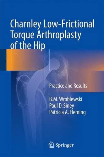 Бумажная книга «Charnley Low-Frictional Torque Arthroplasty of the Hip: Practice and Results», авторов Б.М. Вроблевски, Патриция А. Флеминг, Пол Д. Сини - фото №1