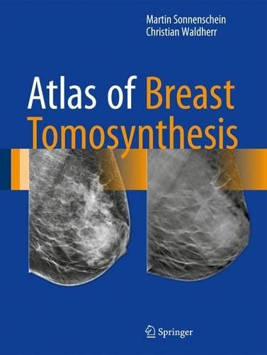 Бумажная книга «Atlas of Breast Tomosynthesis: Imaging Findings and Image-Guided Interventions», авторов Кристиан Вальдерр, Мартин Зонненшайн - фото №1