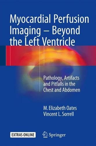 Бумажная книга «Myocardial Perfusion Imaging - Beyond the Left Ventricle: Pathology, Artifacts and Pitfalls in the Chest and Abdomen», авторов М. Элизабет Оутс, Винсент Л. Соррелл - фото №1