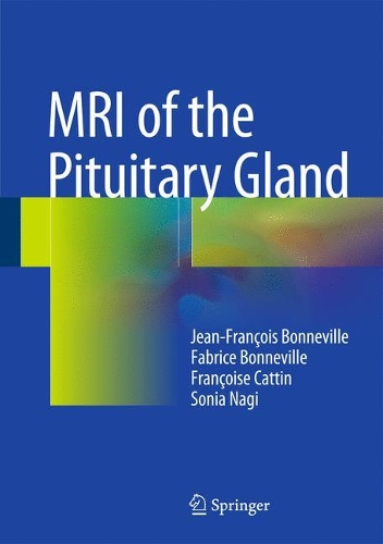 Паперова книга «MRI of the Pituitary Gland», авторів Фабріс Бонневіль, Франсуаза Каттен, Жан-Франсуа Бонневіль, Соня Нагі - фото №1
