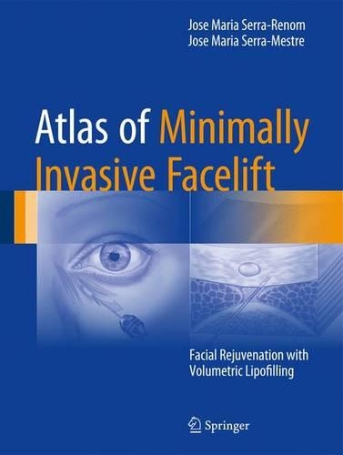Бумажная книга «Atlas of Minimally Invasive Facelift: Facial Rejuvenation with Volumetric Lipofilling», авторов Хосе Мария Серра-Местре, Хосе Мария Серра-Реном - фото №1