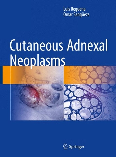 Бумажная книга «Cutaneous Adnexal Neoplasms», авторов Луис Рекена, Омар Сангуэса - фото №1