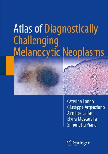 Паперова книга «Atlas of Diagnostically Challenging Melanocytic Neoplasms», авторів Айміліос Лаллас, Катеріна Лонго, Ельвіра Москарелла, Джузеппе Ардженціано, Сімонетта П'яна - фото №1