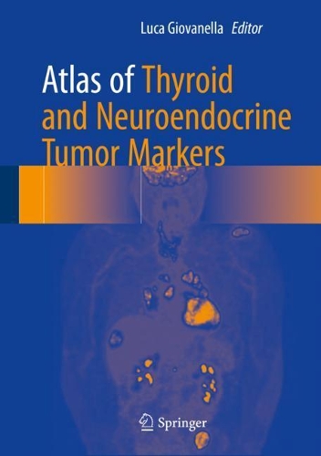 Паперова книга «Atlas of Thyroid and Neuroendocrine Tumor Markers» - фото №1