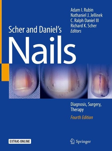 Бумажная книга «Scher and Daniel's Nails: Diagnosis, Surgery, Therapy» - фото №1
