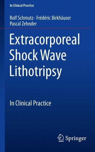Бумажная книга «Extracorporeal Shock Wave Lithotripsy: In Clinical Practice», авторов Фредерик Биркхойзер, Паскаль Зендер, Рольф Шмутц - фото №1