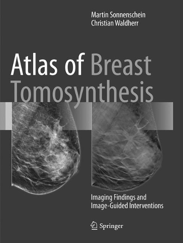 Паперова книга «Atlas of Breast Tomosynthesis: Imaging Findings and Image-Guided Interventions», авторів Крістіан Вальдхерр, Мартін Зонненшайн - фото №1