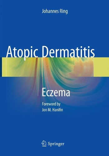 Паперова книга «Atopic Dermatitis: Eczema», автор Йоганнес Рінг - фото №1
