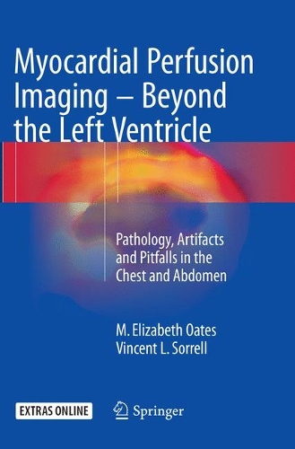 Паперова книга «Myocardial Perfusion Imaging - Beyond the Left Ventricle: Pathology, Artifacts and Pitfalls in the Chest and Abdomen», авторів М. Елізабет Оутс, Вінсент Л. Соррелл - фото №1