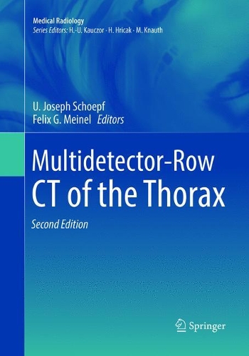 Паперова книга «Multidetector-Row CT of the Thorax» - фото №1