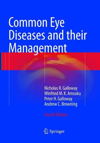 Паперова книга «Common Eye Diseases and their Management», авторів Ендрю Браунінг, Ніколас Р. Геллоуей, Пітер Г. Геллоуей, Вінфрід М. К. Амоаку - фото №1