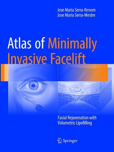 Бумажная книга «Atlas of Minimally Invasive Facelift: Facial Rejuvenation with Volumetric Lipofilling», авторов Хосе Мария Серра-Местре, Хосе Мария Серра-Реном - фото №1