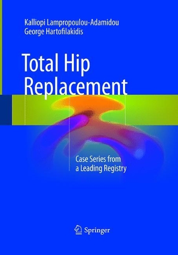Паперова книга «Total Hip Replacement: Case Series from a Leading Registry», авторів Джордж Хартофілакідіс, Калліопі Лампропулу-Адаміду - фото №1