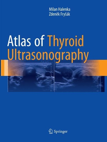 Бумажная книга «Atlas of Thyroid Ultrasonography», авторов Милан Халенка, Зденек Фрышак - фото №1