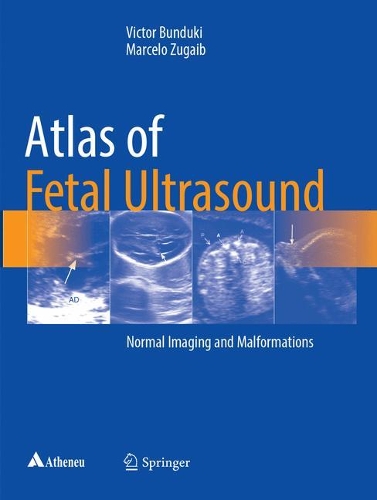 Бумажная книга «Atlas of Fetal Ultrasound: Normal Imaging and Malformations», авторов Марсело Зугаиб, Виктор Бундуки - фото №1