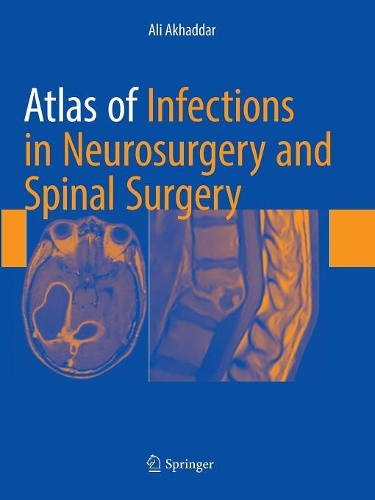 Бумажная книга «Atlas of Infections in Neurosurgery and Spinal Surgery», автор Али Ахаддар - фото №1