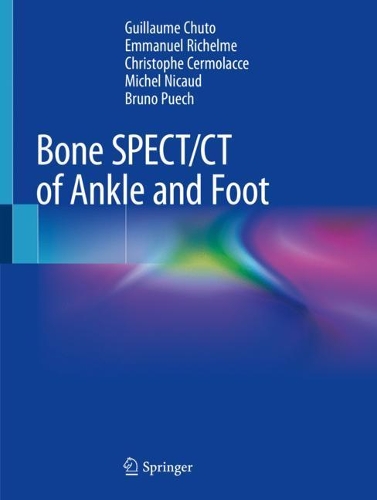 Бумажная книга «Bone SPECT/CT of Ankle and Foot», авторов Бруно Пуэч, Кристоф Чермолачче, Эммануэль Ришельме, Гийом Шуто, Мишель Нико - фото №1