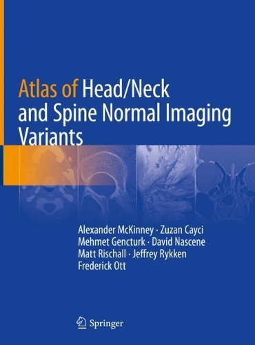 Бумажная книга «Atlas of Head/Neck and Spine Normal Imaging Variants», авторов Александр Маккинни, Дэвид Наскене, Фредерик Отт, Джеффри Райкен, Мэтт Ришалл, Мехмет Генчюрк, Зузана Кайчи - фото №1
