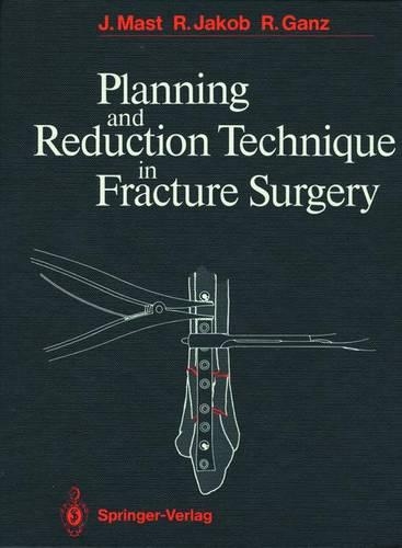 Бумажная книга «Planning and Reduction Technique in Fracture Surgery», авторов Джеффри Маст, Райнхольд Ганц, Роланд Якоб - фото №1