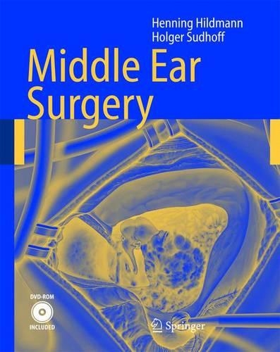 Паперова книга «Middle Ear Surgery», авторів Хеннінг Хільдманн, Хольгер Судгофф - фото №1