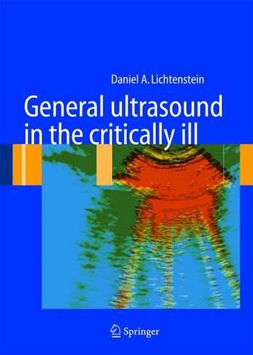 Паперова книга «General ultrasound in the critically ill», автор Даніель А. Ліхтенштейн - фото №1