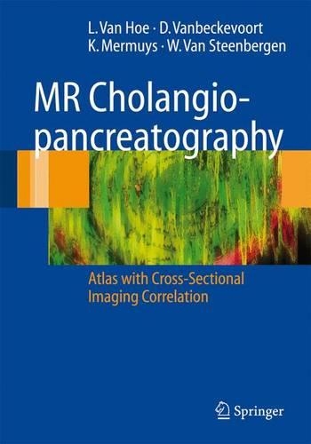 Паперова книга «MR Cholangiopancreatography: Atlas with Cross-Sectional Imaging Correlation», авторів Дірк Ванбекеворт, Коен Мермуйс, Л. ван Хое, Вернер ван Стенберген - фото №1