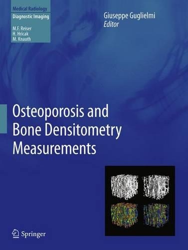 Бумажная книга «Osteoporosis and Bone Densitometry Measurements» - фото №1